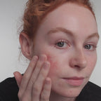 Azelaic Acid Serum 10%