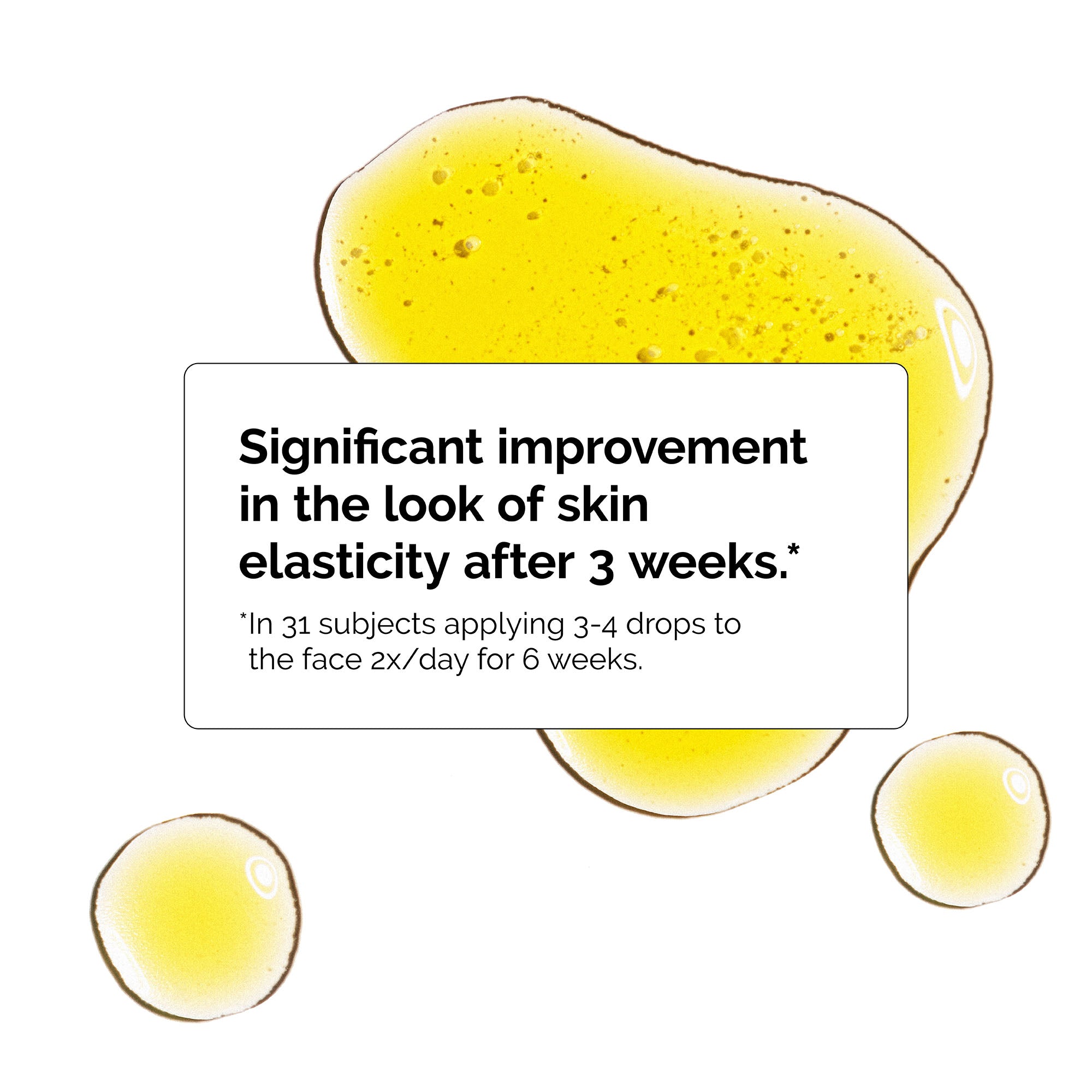 The ordinary Lebanon