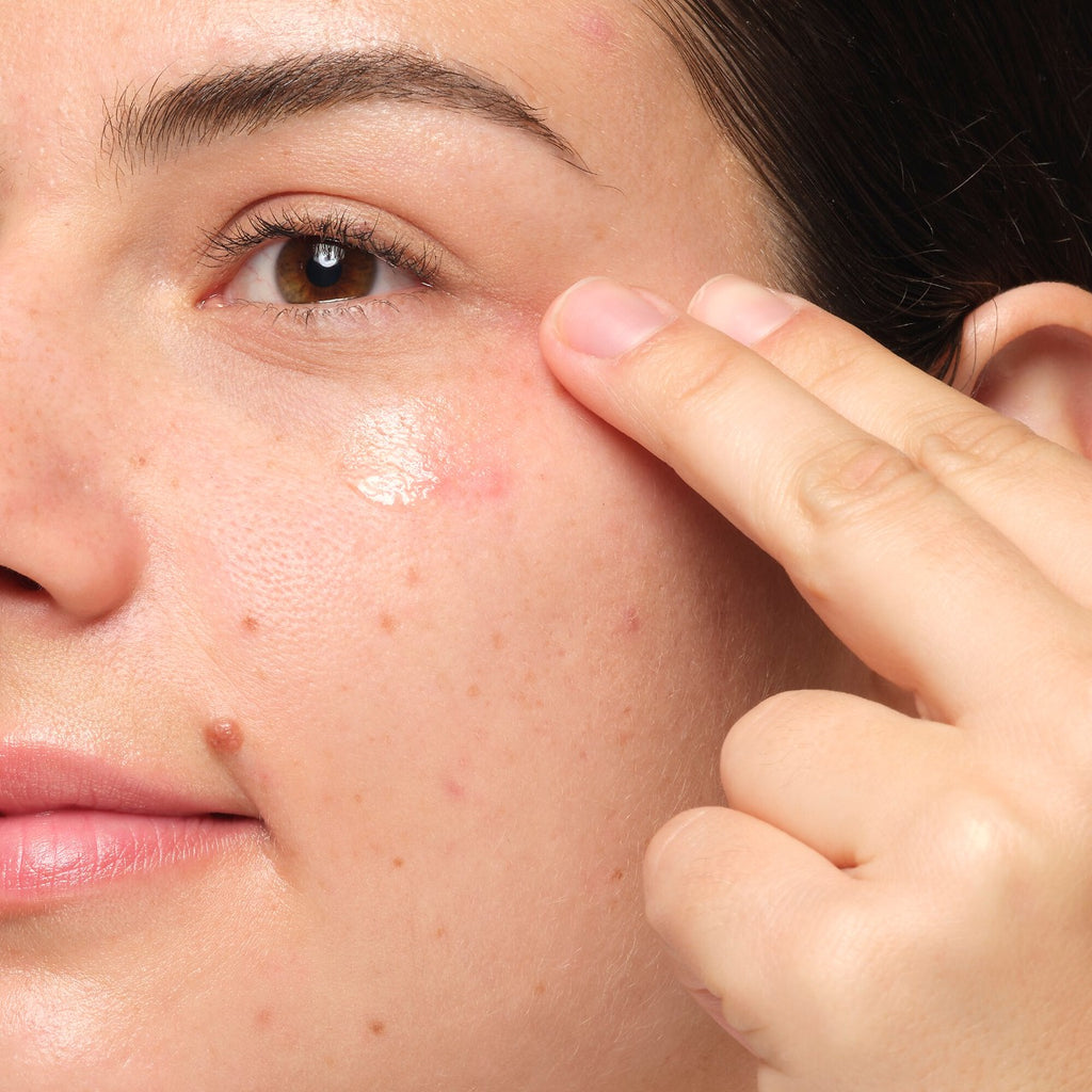 the ordinary serum