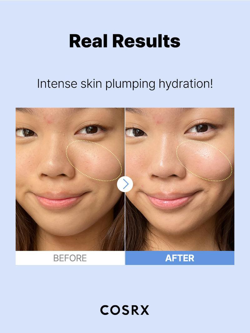 COSRX - The Hyaluronic Acid 3 Serum | MazenOnline