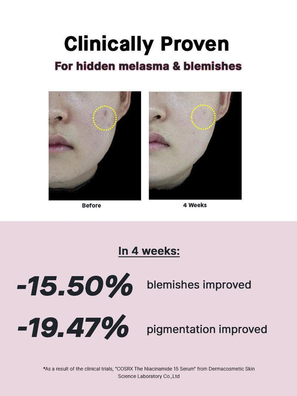COSRX - The Niacinamide 15 Serum | MazenOnline