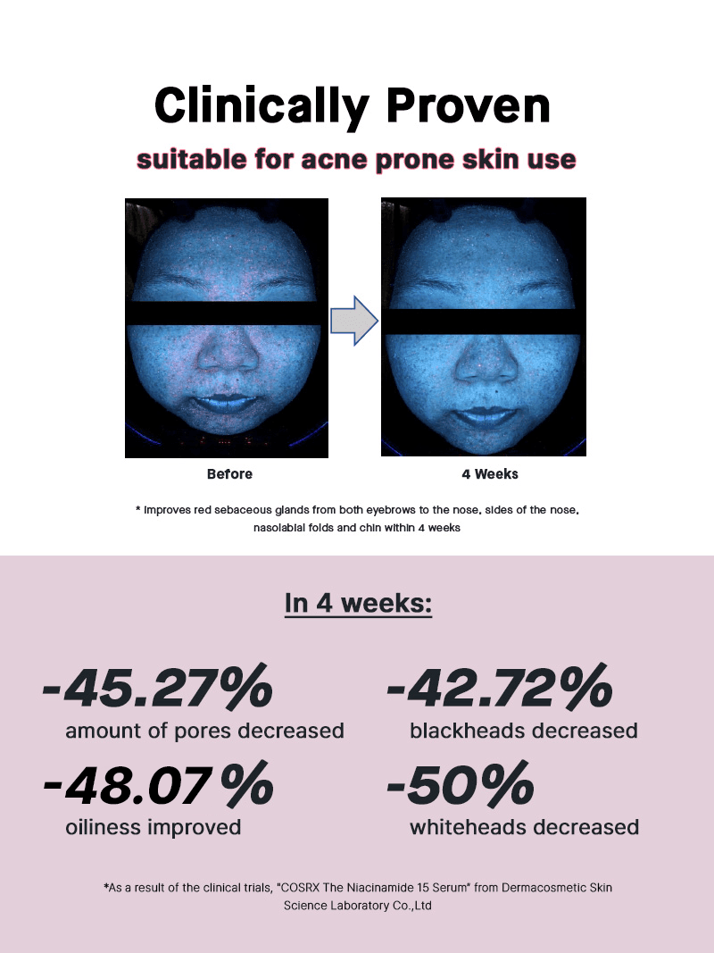 COSRX - The Niacinamide 15 Serum | MazenOnline