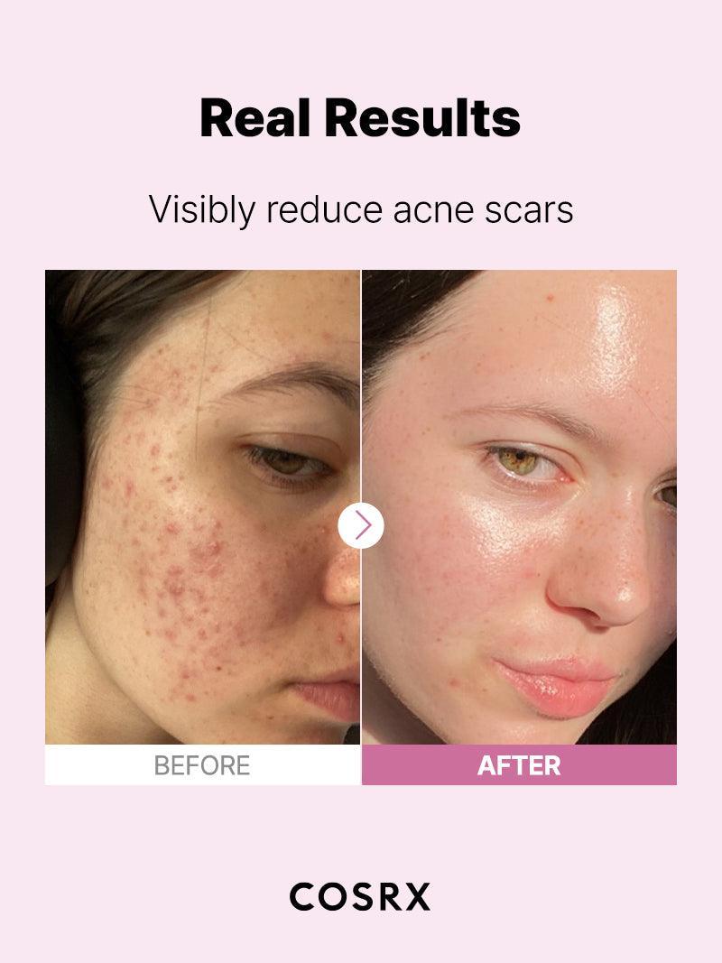COSRX - The Niacinamide 15 Serum | MazenOnline